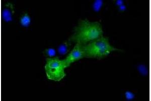 Anti-DYNC1LI1 mouse monoclonal antibody (ABIN2452966) immunofluorescent staining of COS7 cells transiently transfected by pCMV6-ENTRY DYNC1LI1 (RC222010). (DYNC1LI1 Antikörper)
