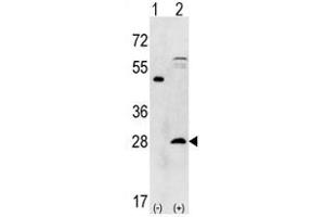 Image no. 1 for anti-Proteasome Subunit alpha 5 (PSMA5) (N-Term) antibody (ABIN356944) (PSMA5 Antikörper  (N-Term))