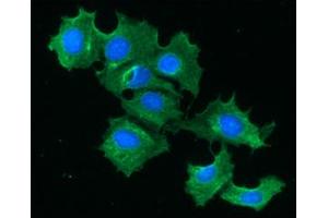 ICC/IF analysis of FABP1 in Hep3B cells line, stained with DAPI (Blue) for nucleus staining and monoclonal anti-human FABP1 antibody (1:100) with goat anti-mouse IgG-Alexa fluor 488 conjugate (Green). (FABP1 Antikörper  (AA 1-127))