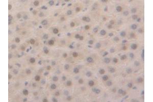 Used in DAB staining on fromalin fixed paraffin-embedded Liver tissue (GSTa5 Antikörper  (AA 1-221))