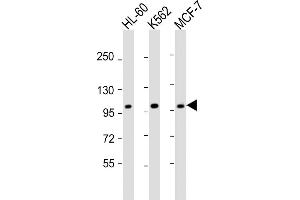 All lanes : Anti-GEN1 Antibody (N-term) at 1:2000 dilution Lane 1: HL-60 whole cell lysate Lane 2: K562 whole cell lysate Lane 3: MCF-7 whole cell lysate Lysates/proteins at 20 μg per lane. (GEN1 Antikörper  (N-Term))