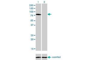 Western blot analysis of CD97 over-expressed 293 cell line, cotransfected with CD97 Validated Chimera RNAi (Lane 2) or non-transfected control (Lane 1).