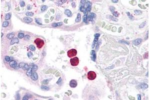 Human Neutrophils: Formalin-Fixed, Paraffin-Embedded (FFPE)