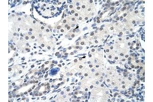 SNRPA antibody was used for immunohistochemistry at a concentration of 4-8 ug/ml to stain Epithelial cells of renal tubule (arrows) in Human Kidney. (SNRPA1 Antikörper  (Middle Region))