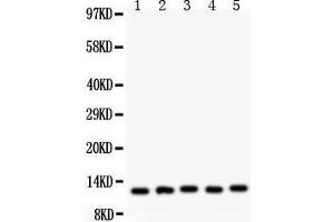 Anti- MIF Picoband antibody, Western blotting All lanes: Anti MIF  at 0. (MIF Antikörper  (AA 2-115))