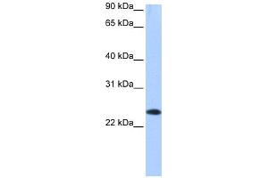 WB Suggested Anti-EGLN3 Antibody Titration: 0. (EGLN3 Antikörper  (C-Term))