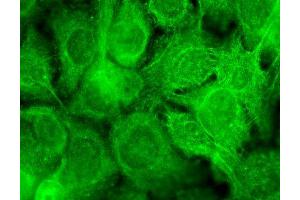 Immunofluorescence (fixed cells) (IF/ICC) image for anti-Transient Receptor Potential Cation Channel, Subfamily V, Member 3 (TRPV3) (AA 458-474) antibody (HRP) (ABIN2485244)