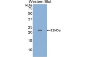 Detection of Recombinant PARK7, Human using Polyclonal Antibody to Parkinson Disease Protein 7 (PARK7) (PARK7/DJ1 Antikörper  (AA 1-189))