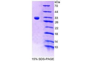 SDS-PAGE (SDS) image for Coagulation Factor XIII, A1 Polypeptide (F13A1) (AA 372-616) protein (His tag) (ABIN2124423) (F13A1 Protein (AA 372-616) (His tag))