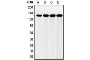 Western blot analysis of FGFR2 expression in HeLa (A), Jurkat (B), HEK293T (C), mouse liver (D) whole cell lysates. (FGFR2 Antikörper  (Center))