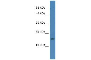 Host: Rabbit Target Name: ELAC2 Sample Type: HepG2 Whole cell lysates Antibody Dilution: 1. (ELAC2 Antikörper  (C-Term))
