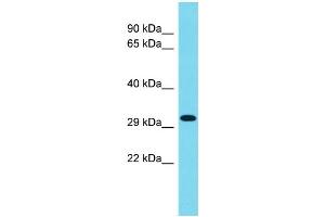 Host: Rabbit Target Name: CCDC75 Sample Type: 293T Whole Cell lysates Antibody Dilution: 1. (CCDC75 Antikörper  (C-Term))