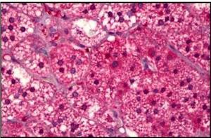 Human Adrenal Cortex: Formalin-Fixed, Paraffin-Embedded (FFPE) (SUCNR1 Antikörper)