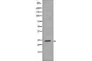 Western blot analysis of extracts from HeLa cells using SFRS3 antibody. (SRSF3 Antikörper  (C-Term))