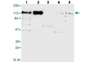 Western blot analysis of Lane 1: RT-4, Lane 2: U-251 MG, Lane 3: Human Plasma, Lane 4: Liver, Lane 5: Tonsil with CEP97 polyclonal antibody  at 1:250-1:500 dilution. (CEP97 Antikörper)