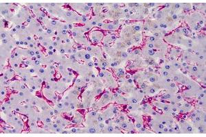 Human Liver: Formalin-Fixed, Paraffin-Embedded (FFPE) (Caveolin-1 Antikörper)