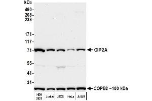 Western Blotting (WB) image for anti-KIAA1524 (KIAA1524) (N-Term) antibody (ABIN7452647) (KIAA1524 Antikörper  (N-Term))