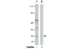 Western blot analysis of extracts from Raw 264. (CREBZF Antikörper)