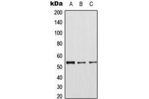 Western blot analysis of CDK8 expression in HepG2 (A), A549 (B), Raw264.