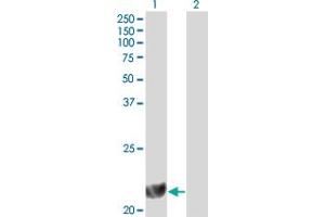 Western Blotting (WB) image for anti-Dihydrofolate Reductase (DHFR) (AA 88-187) antibody (ABIN560600)