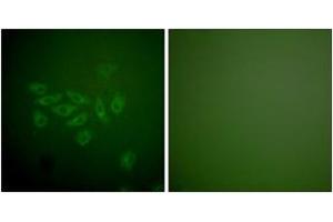 Immunofluorescence analysis of A549 cells, using FHIT Antibody.