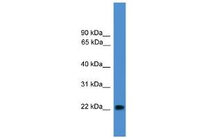 WB Suggested Anti-NUDT16L1 Antibody Titration:  0.