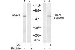 Image no. 1 for anti-Histone Deacetylase 2 (HDAC2) (pSer394) antibody (ABIN319237) (HDAC2 Antikörper  (pSer394))