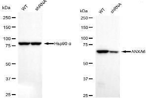 Western blotting analysis using annexin A6 antibody (ABIN7797624). (Rekombinanter ANXA6 Antikörper)