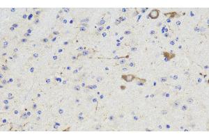 Immunohistochemistry analysis of paraffin-embedded Mouse brain using NOS1 Polyclonal Antibody at dilution of 1:300. (NOS1 Antikörper)