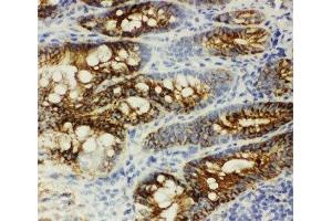 IHC-F: beta Catenin antibody testing of rat intestine tissue (beta Catenin Antikörper  (AA 764-781))