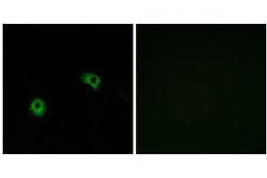 Immunofluorescence analysis of A549 cells, using GPR116 antibody. (G Protein-Coupled Receptor 116 Antikörper  (C-Term))