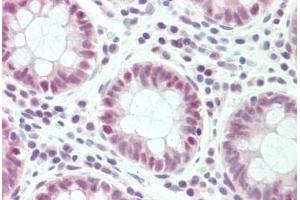 anti-Solute Carrier Family 4 (Anion Exchanger), Member 1, Adaptor Protein (SLC4A1AP) (AA 421-470) antibody