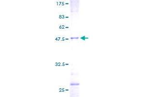 SDS-PAGE (SDS) image for Transgelin (TAGLN) (AA 1-201) protein (GST tag) (ABIN1322120)