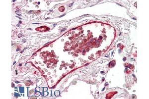 ABIN185480 (5µg/ml) staining of paraffin embedded Human Lung. (DARC Antikörper  (N-Term))