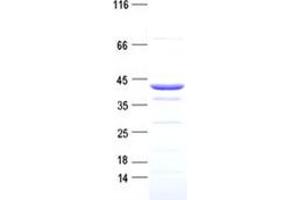 Validation with Western Blot (OTC Protein (DYKDDDDK Tag))