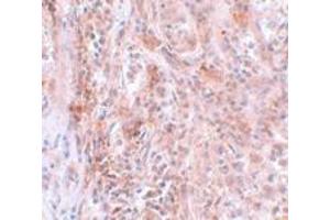 Immunohistochemistry (IHC) image for anti-Breast Carcinoma Amplified Sequence 2 (BCAS2) (C-Term) antibody (ABIN1030285) (BCAS2 Antikörper  (C-Term))