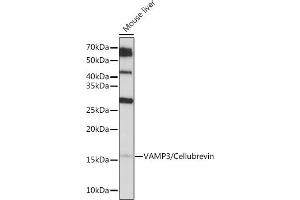 Western blot analysis of extracts of Mouse liver, using V/V/Cellubrevin Rabbit mAb (ABIN7271314) at 1:1000 dilution. (VAMP3 Antikörper)