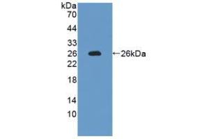 Western blot analysis of recombinant Rat IL12A. (IL12A Antikörper  (AA 23-215))