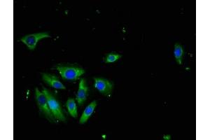 Immunofluorescence staining of A549 cells with ABIN7173786 at 1:100, counter-stained with DAPI. (LTA Antikörper  (AA 39-281))