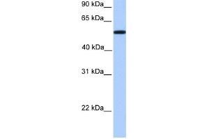 WB Suggested Anti-UGT2A3 Antibody Titration:  0. (UGT2A3 Antikörper  (Middle Region))