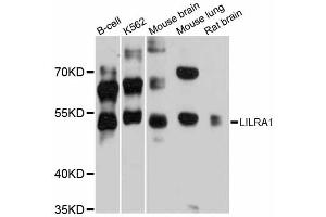 Western blot analysis of extracts of various cell lines, using LILRA1 antibody (ABIN6293167) at 1:3000 dilution. (LILRA1 Antikörper)