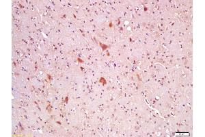 Formalin-fixed and paraffin embedded rat brain labeled with Anti-Wnt8A Polyclonal Antibody, Unconjugated (ABIN762851) at 1:200 followed by conjugation to the secondary antibody and DAB staining (WNT8A Antikörper  (AA 201-300))