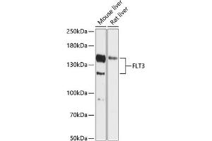Western blot analysis of extracts of various cell lines, using FLT3 antibody (ABIN6134577, ABIN6140692, ABIN6140695 and ABIN6216099) at 1:1000 dilution. (FLT3 Antikörper  (AA 650-750))