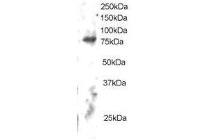 Image no. 1 for anti-Engulfment and Cell Motility 2 (ELMO2) (C-Term) antibody (ABIN374161) (ELMO2 Antikörper  (C-Term))
