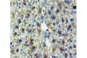 Used in DAB staining on fromalin fixed paraffin-embedded Liver tissue