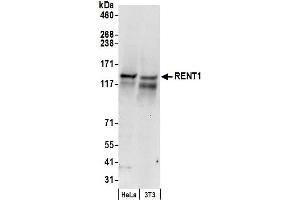 anti-UPF1 Regulator of Nonsense Transcripts Homolog (UPF1) (AA 250-300) antibody