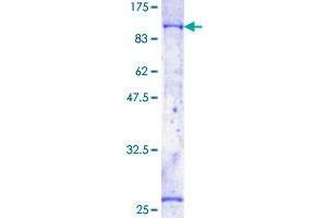 BTK Protein (AA 1-659) (GST tag)