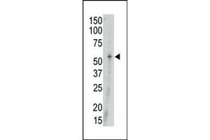 Image no. 2 for anti-Megakaryocyte-Associated tyrosine Kinase (MATK) (N-Term) antibody (ABIN359988) (MATK Antikörper  (N-Term))