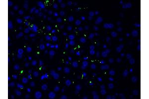 Immunofluorescence (fixed cells) (IF/ICC) image for anti-LIM Domain Kinase 1 (LIMK1) (pThr508) antibody (ABIN6255701)