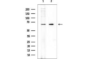 anti-Solute Carrier Family 47, Member 2 (SLC47A2) antibody